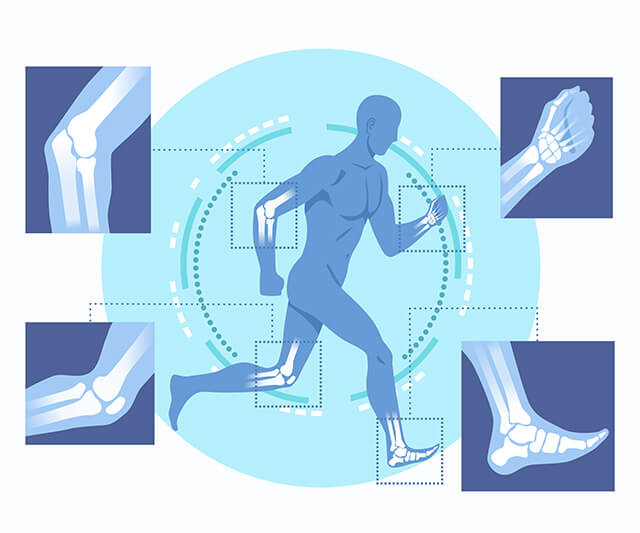Ein schematisch dargestellter Mann rennt. Sein Bewegungsapparat wird exemplarisch abgebildet.